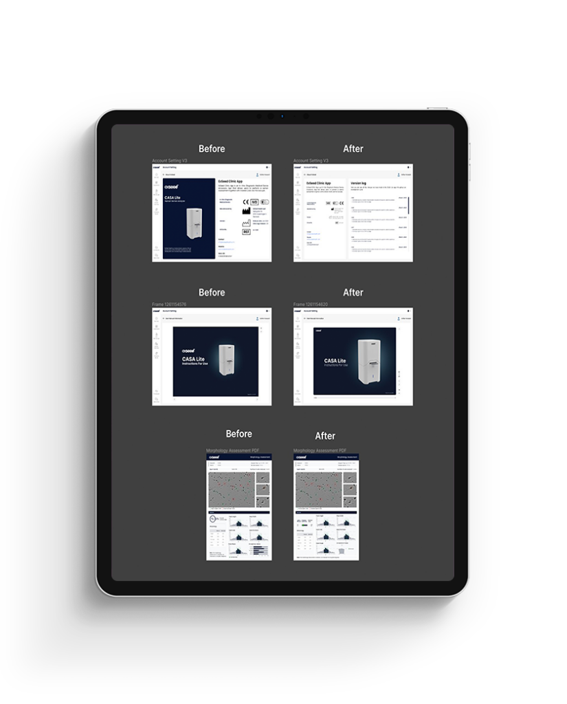 ExSeed Health CASA Lite Screens on tablet, before and after screens. (Figma)